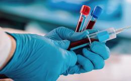 Lekarz pobiera krew do analizy do probówek 